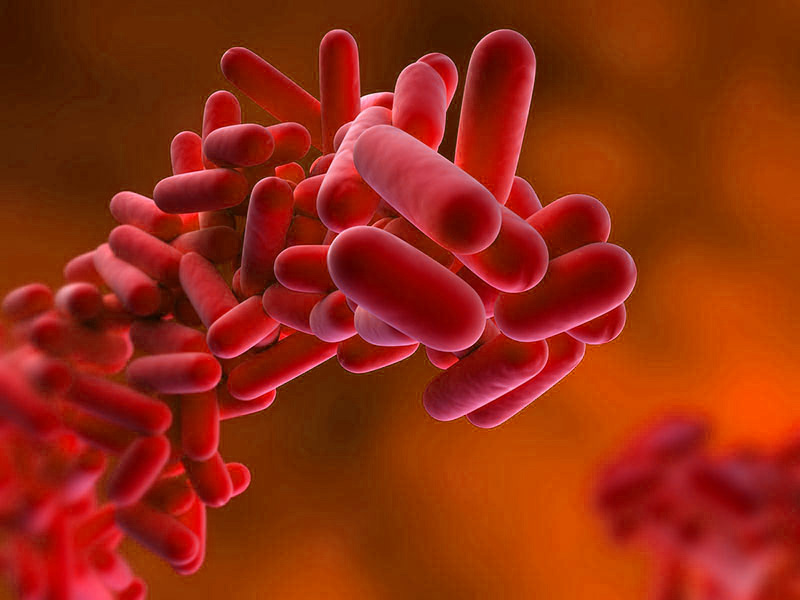 Legionella